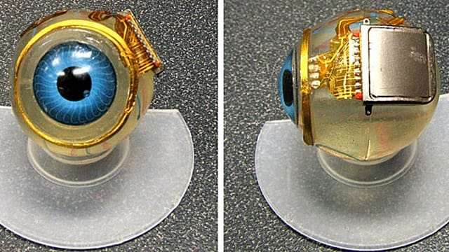 The First in the World: A Breakthrough for Vision Restoration in the Blind: Bionic Eye...